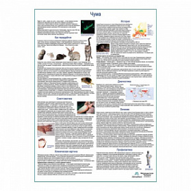 Чума, медицинский плакат А1+/А2+ (глянцевая фотобумага от 200 г/кв.м, размер A2+) Чума, медицинский плакат А1+/А2+ (глянцевая фотобумага от 200 г/кв.м, размер A2+)