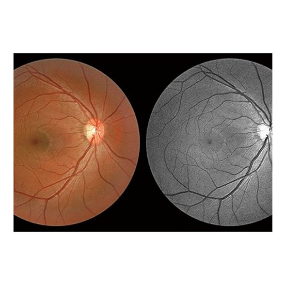 Томограф спектральный оптический когерентный, вариант исполнения: НОСТ-1, HUVITZ