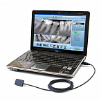 Анвизиограф - цифровой радиовизиограф