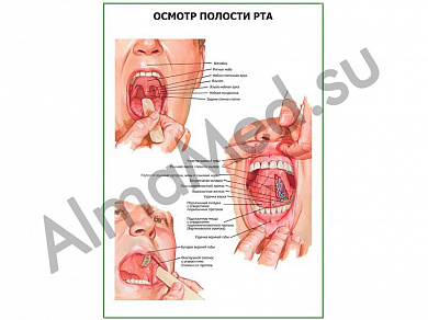 Осмотр полости рта плакат глянцевый/ламинированный А1/А2 (глянцевый	A2)