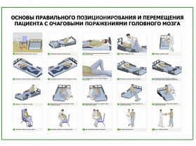 Основы правильного позиционирования и перемещения пациента с очаговыми поражениями головного мозга плакат глянцевый А1/А2 (глянцевый A1)