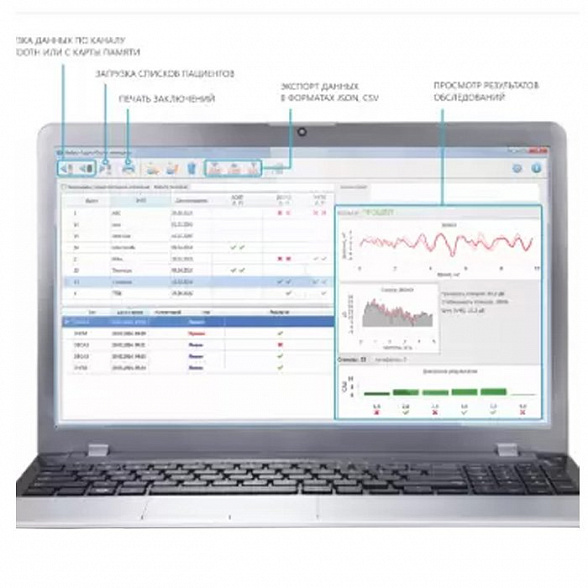 Система регистрации отоакустической эмиссии «Аудио-СМАРТ»