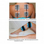 Аппарат для электротерапии и электростимуляции Ibramed Neurodyn (6 каналов)