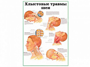 Хлыстовые травмы шеи, плакат глянцевый  А1/А2 (глянцевый A2)