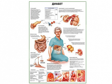 Диабет плакат глянцевый А1/А2 (глянцевый A1)