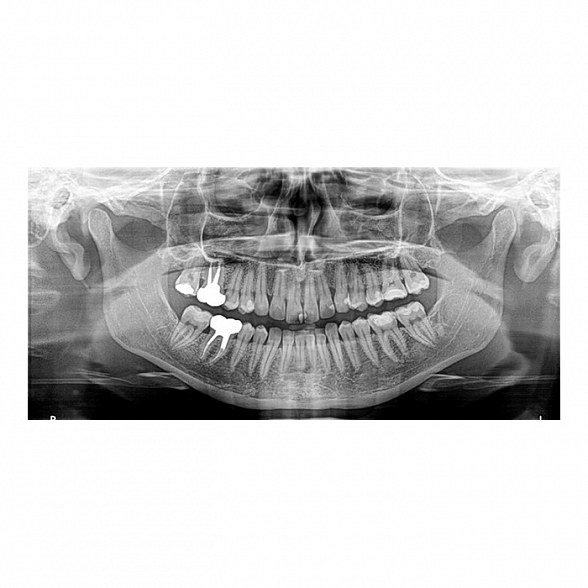 Carestream Dental CS 8100 3D - трехмерный томограф