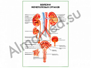 Болезни мочеполовых органов плакат ламинированный А1/А2 (ламинированный A2)