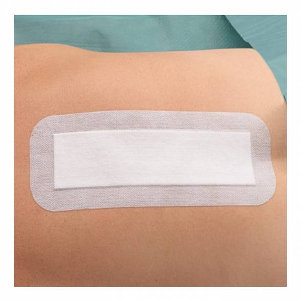 Повязка пластырного типа, впитывающая, стерильная, "Докапласт", 6*10см., №25