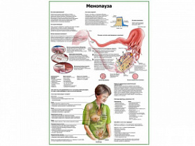 Менопауза плакат глянцевый А1/А2 (глянцевый A1)