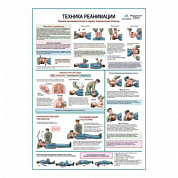 Техника реанимации, медицинский плакат А1+/А2+ (матовый холст от 200 г/кв.м, размер A1+)