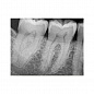 Carestream Dental RVG 6200 - радиовизиограф, 24 пар линий/мм