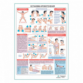 Остановка кровотечения, плакат глянцевый А1+/А2+ (матовый холст от 200 г/кв.м, размер A1+)