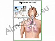 Бронхоскопия, плакат ламинированный А1/А2 (ламинированный	A2)