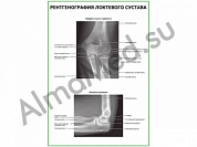 Рентгенография локтевого сустава плакат глянцевый/ламинированный А1/А2 (глянцевый	A2)