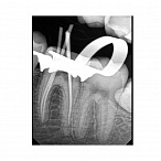 Carestream Dental RVG 6200 - радиовизиограф, 24 пар линий/мм
