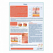 Рожа медицинский плакат А1+/A2+ (глянцевый холст от 200 г/кв.м, размер A1+)