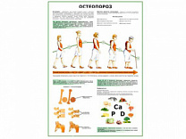 Остеопороз плакат глянцевый А1/А2 (глянцевый A1)