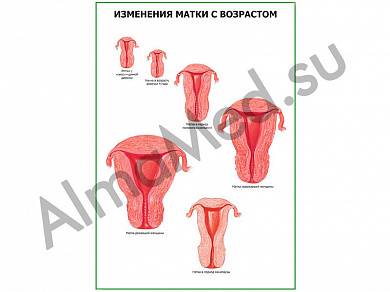 Возрастные изменения матки плакат ламинированный А1/А2 (ламинированный	A2)