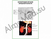 Ангиография органов брюшной полости плакат ламинированный А1/А2 (ламинированный	A2)