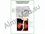 Ангиография органов брюшной полости плакат глянцевый/ламинированный А1/А2 (глянцевый	A2)