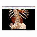 Информационная система АПК АрхиМед PACS/RIS
