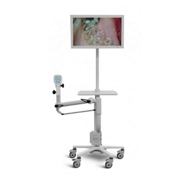 Видеокольпоскоп Цифровой SLV-101