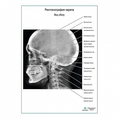 Рентгенография черепа. Вид сбоку плакат глянцевый А1+/А2+ (матовый холст от 200 г/кв.м, размер A1+)