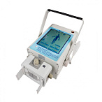 Портативный рентген DS.Xray 8010tb