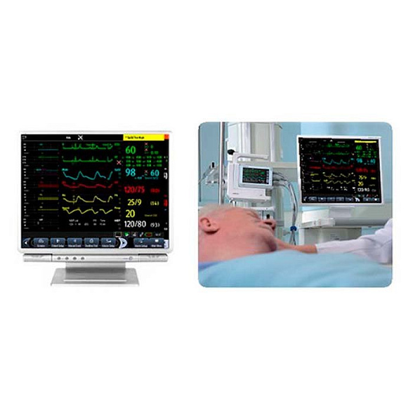 Док-станция BeneView TDS Mindray