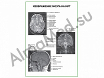 Изображение мозга на МРТ плакат глянцевый/ламинированный А1/А2 (глянцевый	A2)