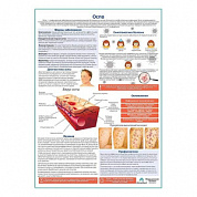 Оспа медицинский плакат А1+/A2+ (глянцевая фотобумага от 200 г/кв.м, размер A1+)