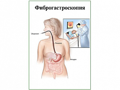 Фиброгастроскопия, плакат глянцевый А1/А2 (глянцевый A2)
