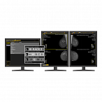 AI-платформа для анализа маммограмм ТриоДМ-МТ