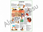 Аллергия плакат глянцевый/ламинированный А1/А2 (глянцевый A2)