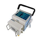 Портативный рентген DS.Xray 3510t