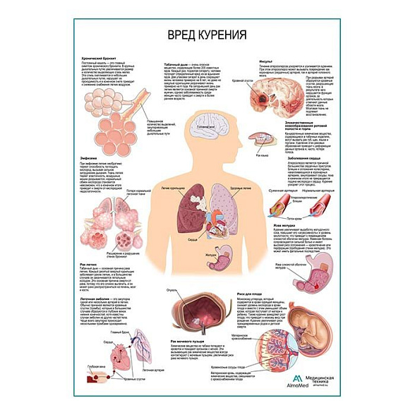Вред курения плакат глянцевый А1+/А2+ (глянцевая фотобумага от 200 г/кв.м, размер A2+)