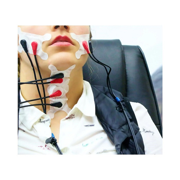 Аппарат для нейромышечной стимуляции неба, глотки, гортани с набором электродов «VitalStim Plus»