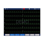 Электрокардиограф IMAC-1200
