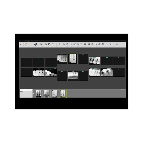 Genoray X-RAY SENSOR E9525 - радиовизиографическая система