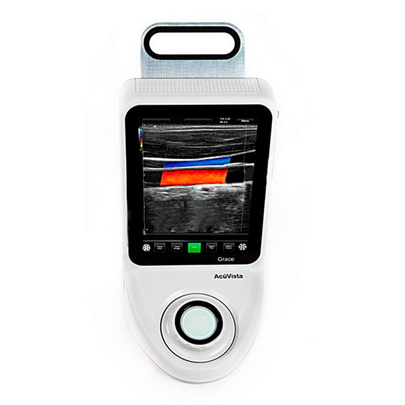 УЗИ-сканер AcuVista Grace