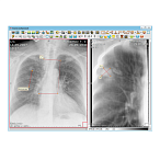 Информационная система АПК АрхиМед PACS/RIS