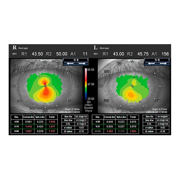 Анализатор волнового фронта KR-1W, Topcon