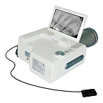 Dexcowin ADX-4000 - высокочастотный портативный рентген + визиограф + компьютер