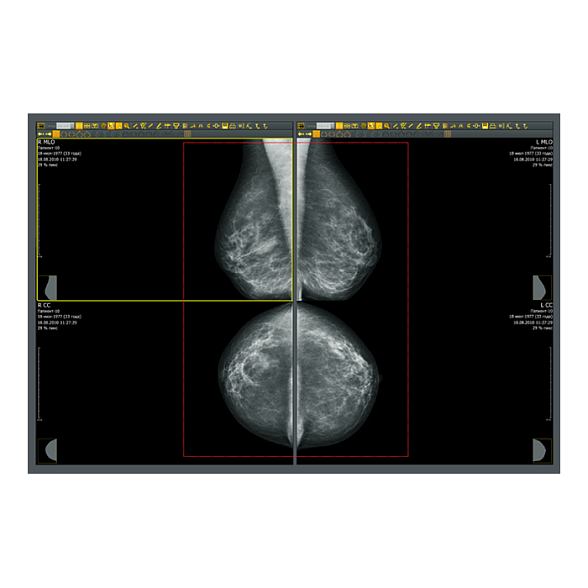 Аппаратно-программный комплекс «ДИАРМ-МТ-Плюс»