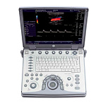 Портативный ультразвуковой аппарат GE Healthcare Voluson E