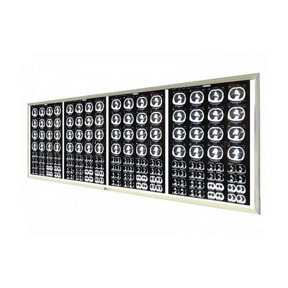 Негатоскоп LED на 4 снимка