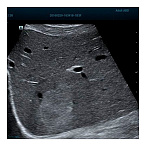 Ультразвуковая диагностическая система экспертного класса MINDRAY RESONA 6 EXP.