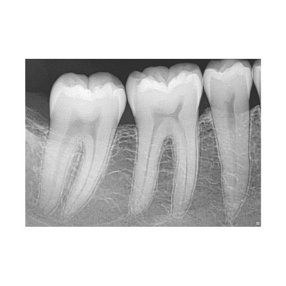 Dentsply Sirona XIOS XG SUPREME USB MODUL - модульная сенсорная система со сменным кабелем