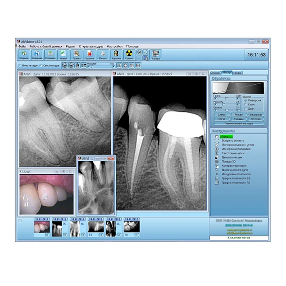 Анвизиограф - цифровой радиовизиограф