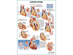 OLD Болезни сердца, плакат глянцевый А1/А2 (глянцевый A1)